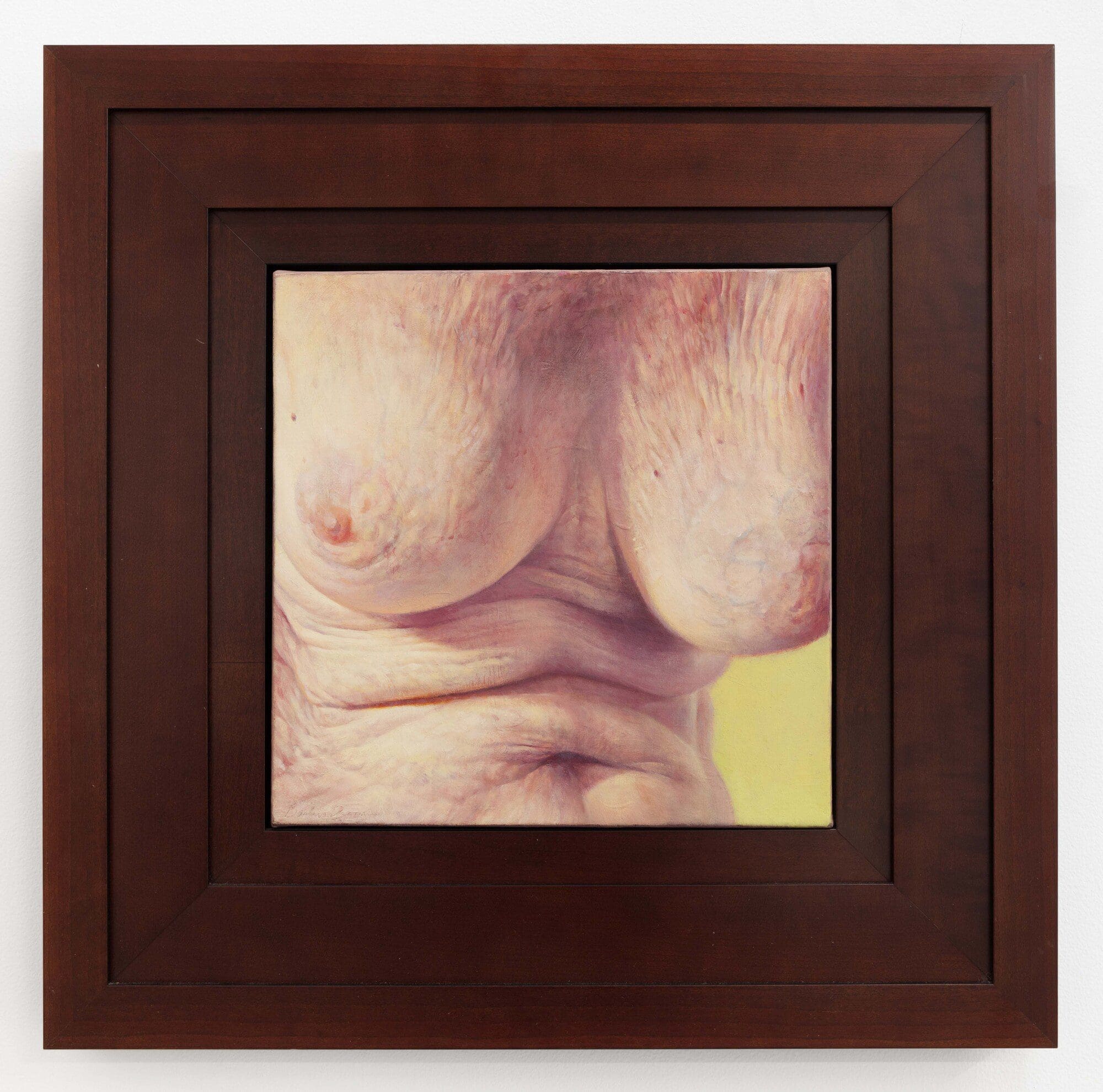 Bailey Doogan Breast, Age 59, 2001 Oil on linen Image Dimensions: 12 x 12 inches (30.5 x 30.5 cm) Framed Dimensions: 21 5/8 x 21 5/8 inches (54.9 x 54.9 cm)